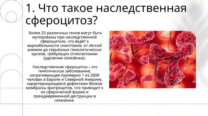 Наследственный микросфероцитоз 3