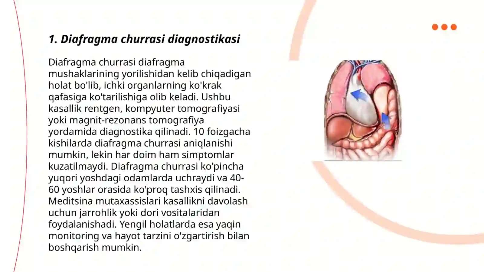 Diafragmal churralar xirurgiyasi 3
