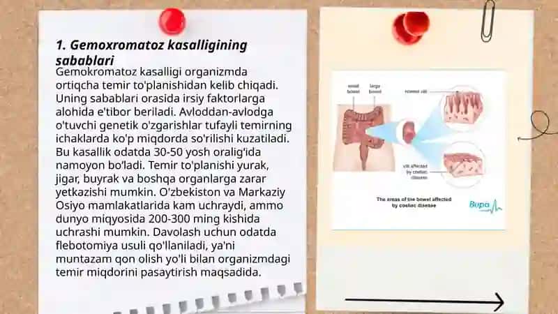 Gemoxromotoz kasaligi 3