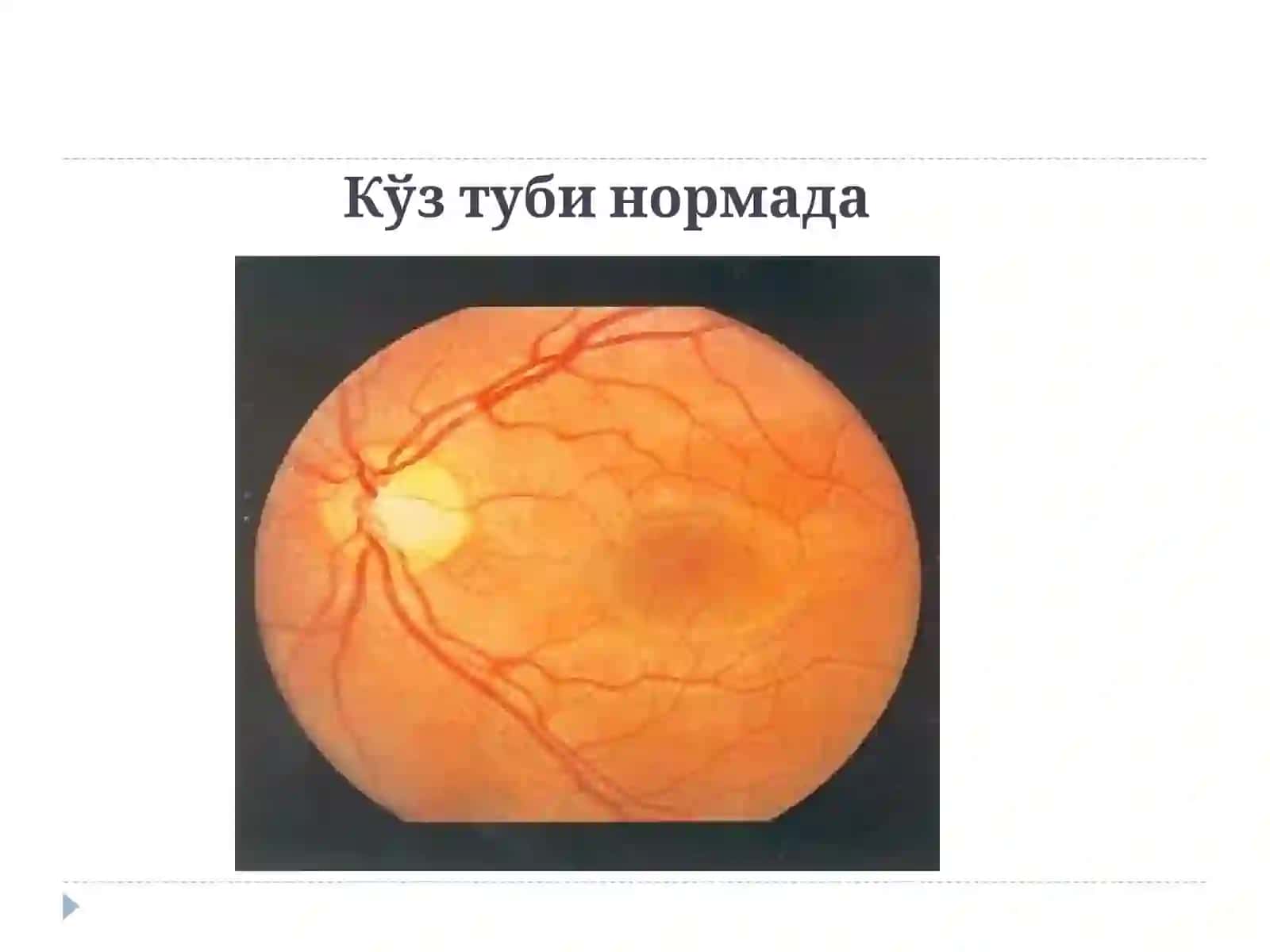 Офтальмология фани 3