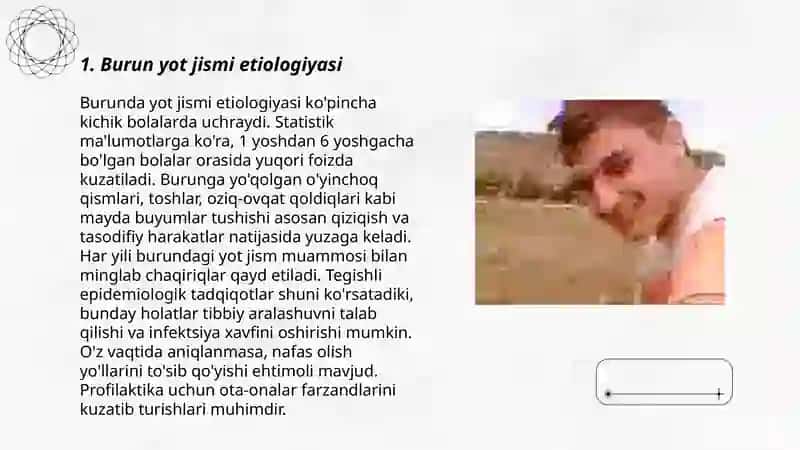 Burun yot jismi etiologiyasi 3