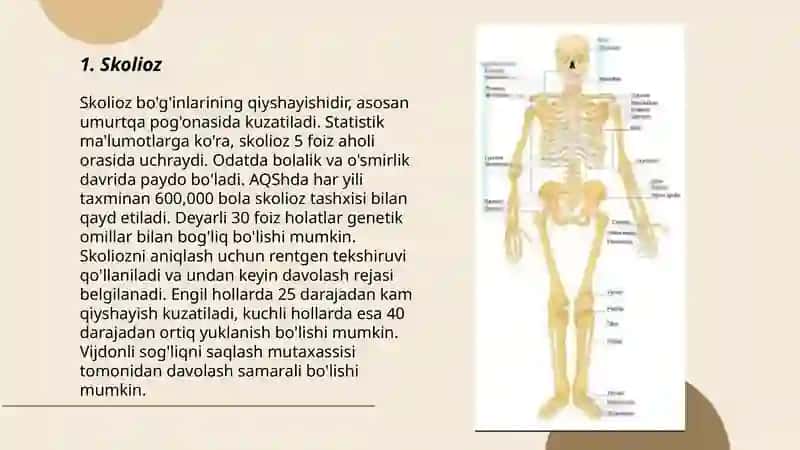 Skeletning rivojlanish anamaliyalari 3