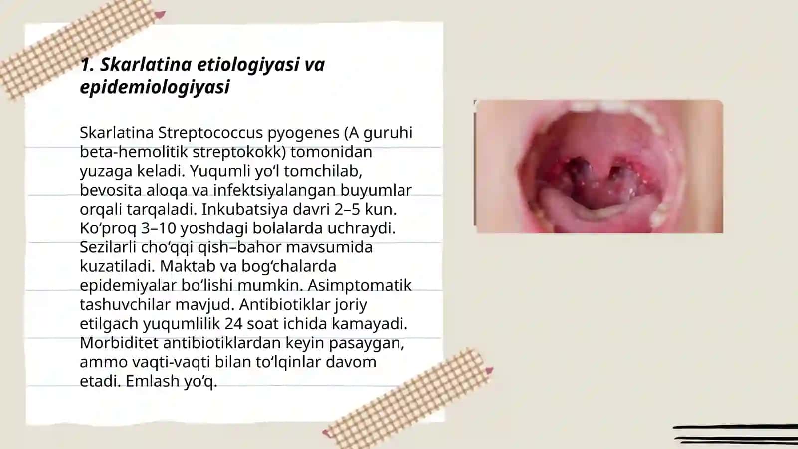 Skarlatina kasalligi 3