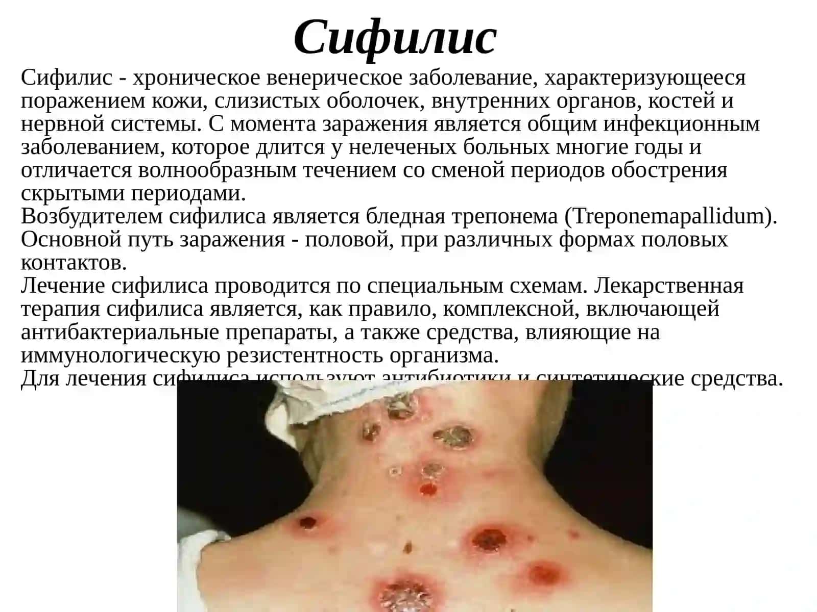 Противосифилитическисредства.Регенерантыирепаранты 3