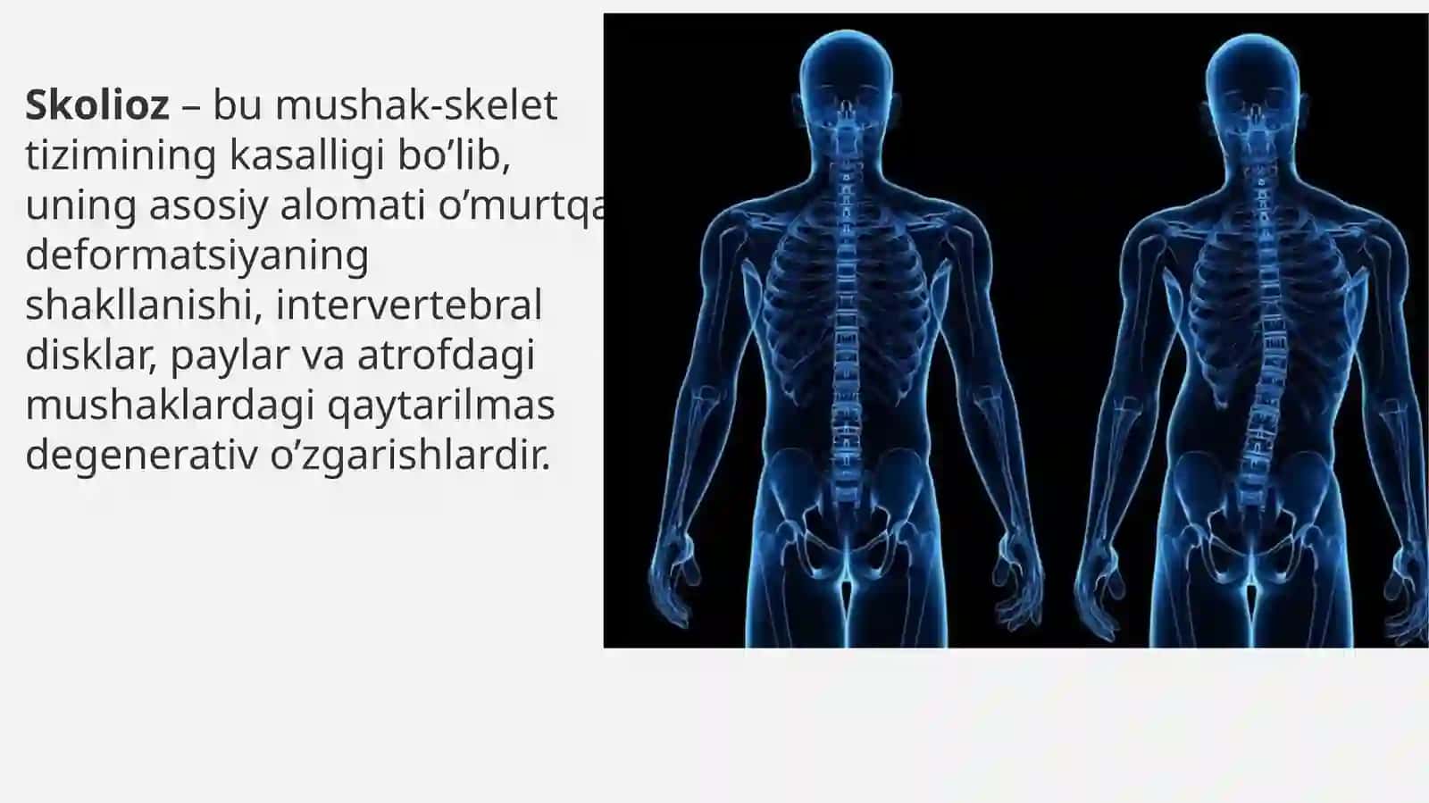 Skalioz 3