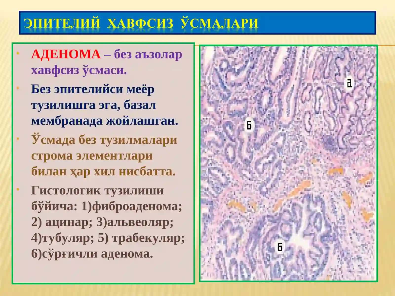 Ўсмалар. Мезенхимал ўсмалар 3