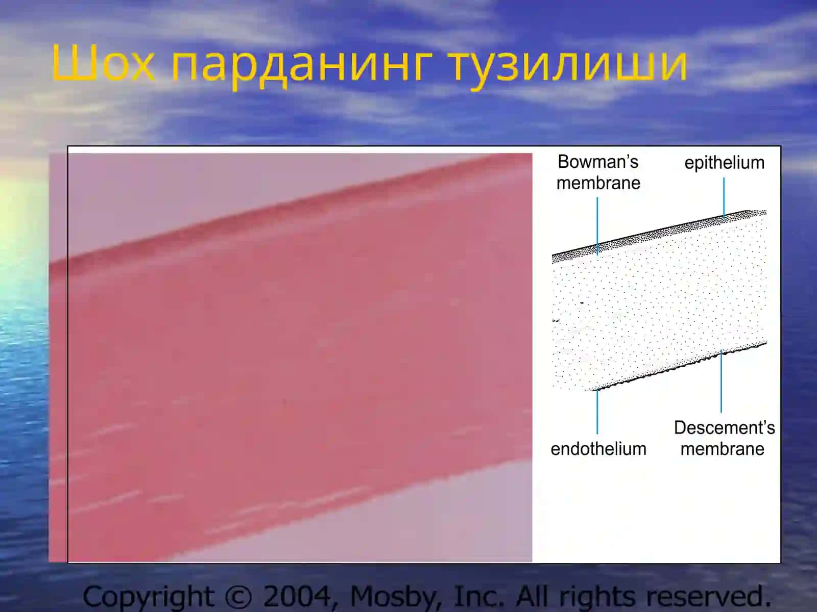 Кератитлар 3