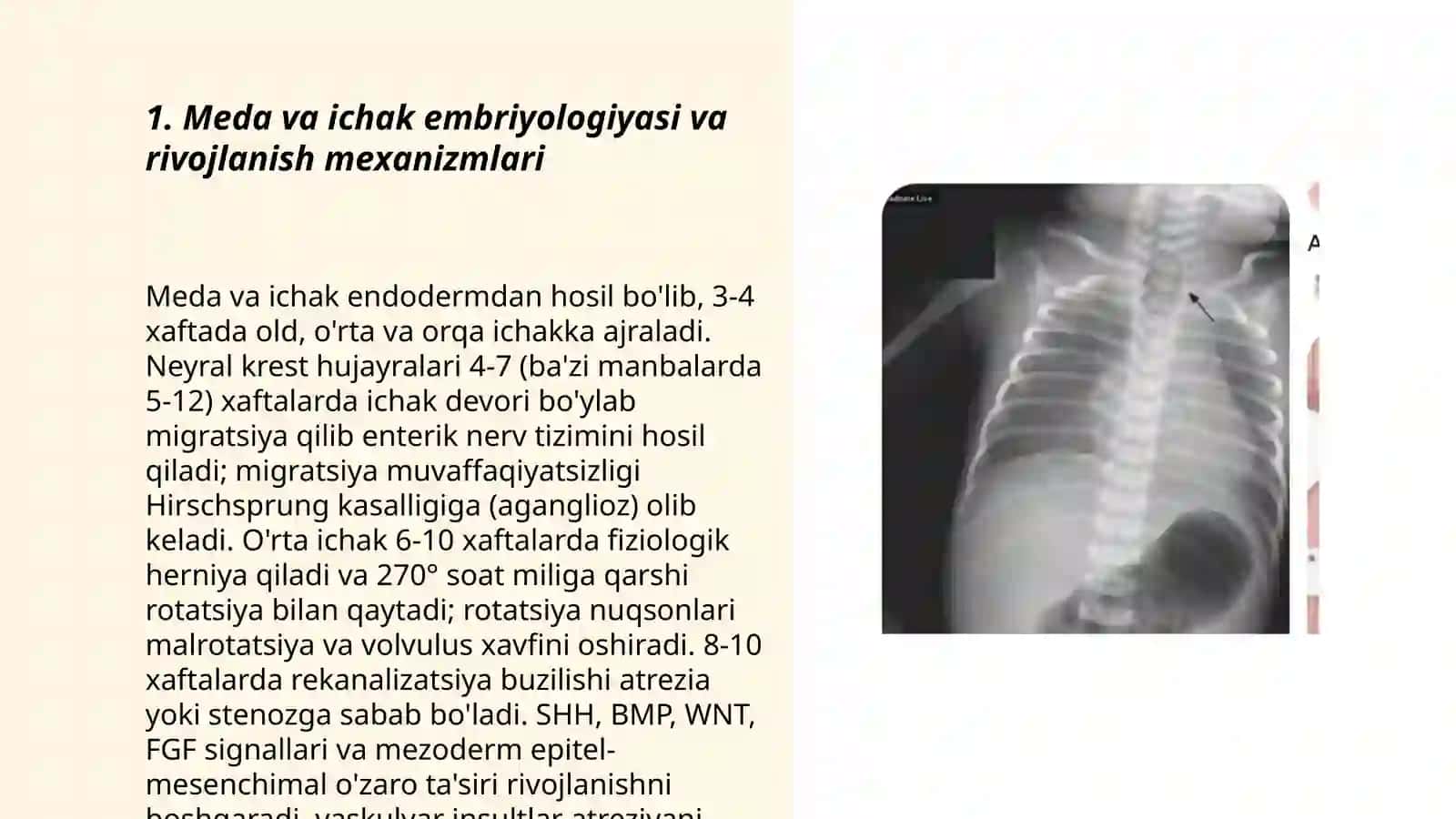 Meda ichak trakti rivojlanishi 3