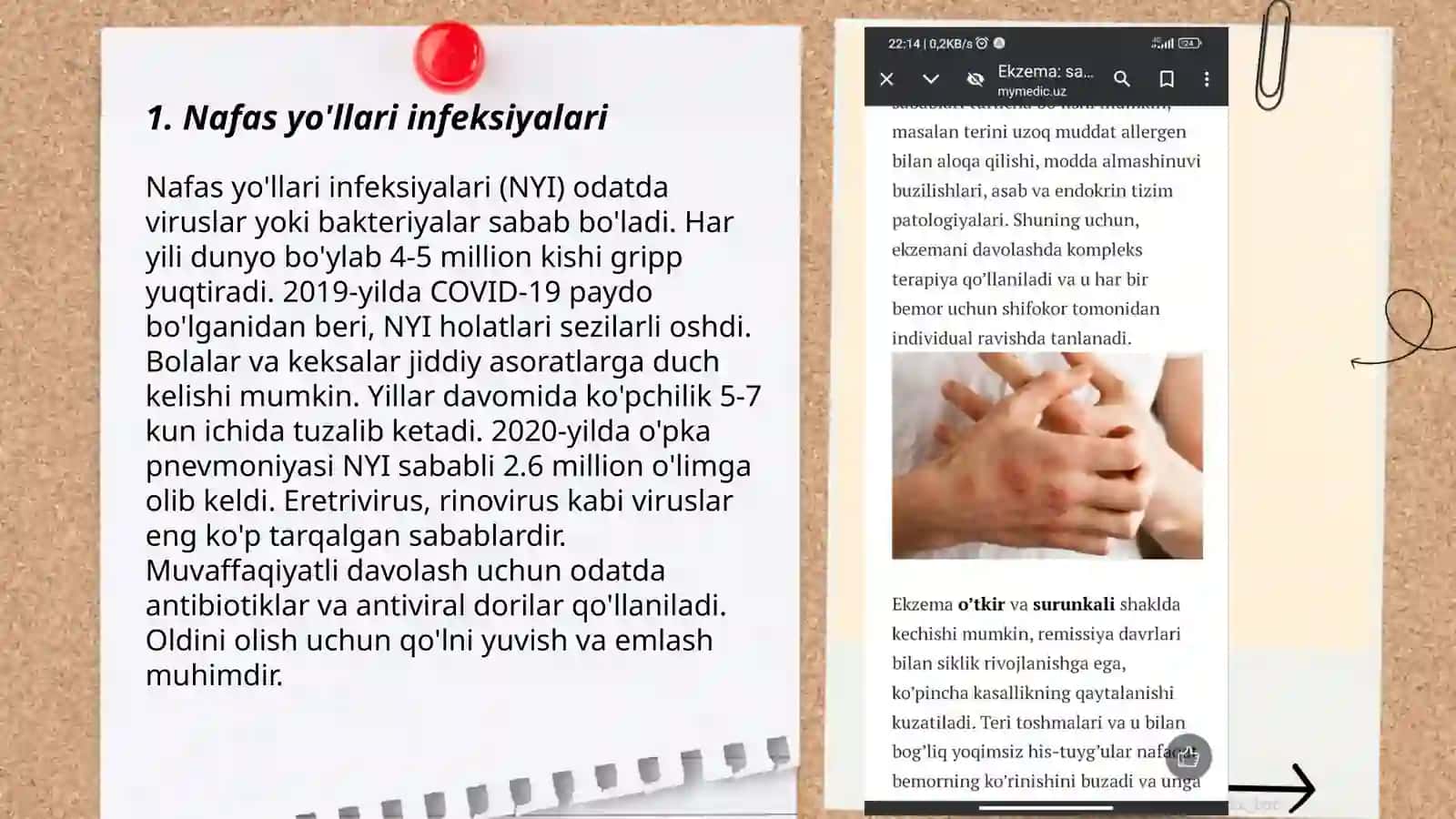 Teri kasalliklari 3