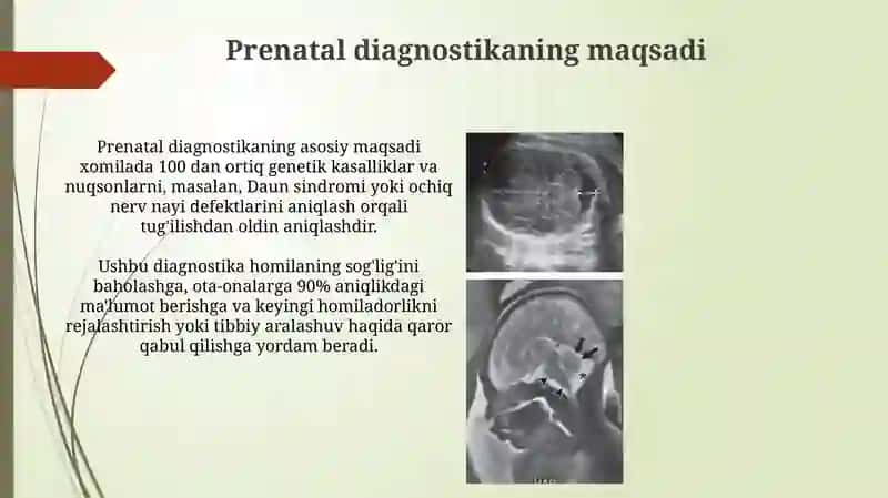 Prenatal diagnostika 3