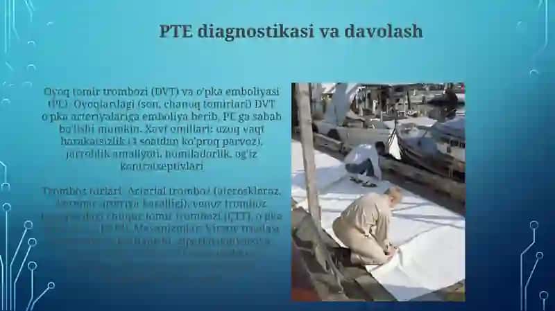 Trombozning turlari va rivojlanishi 3