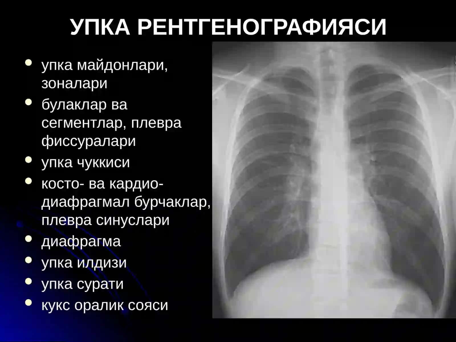 УПКА КАСАЛЛИКЛАРИНИНГ НУР ТАШХИСИ 3