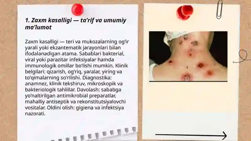 Zaxm kasalligi - taʼrif va umumiy maʼlumot 3