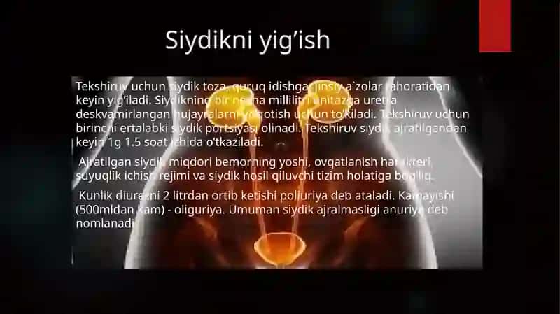 Siydik Umumiy Tahlil 3