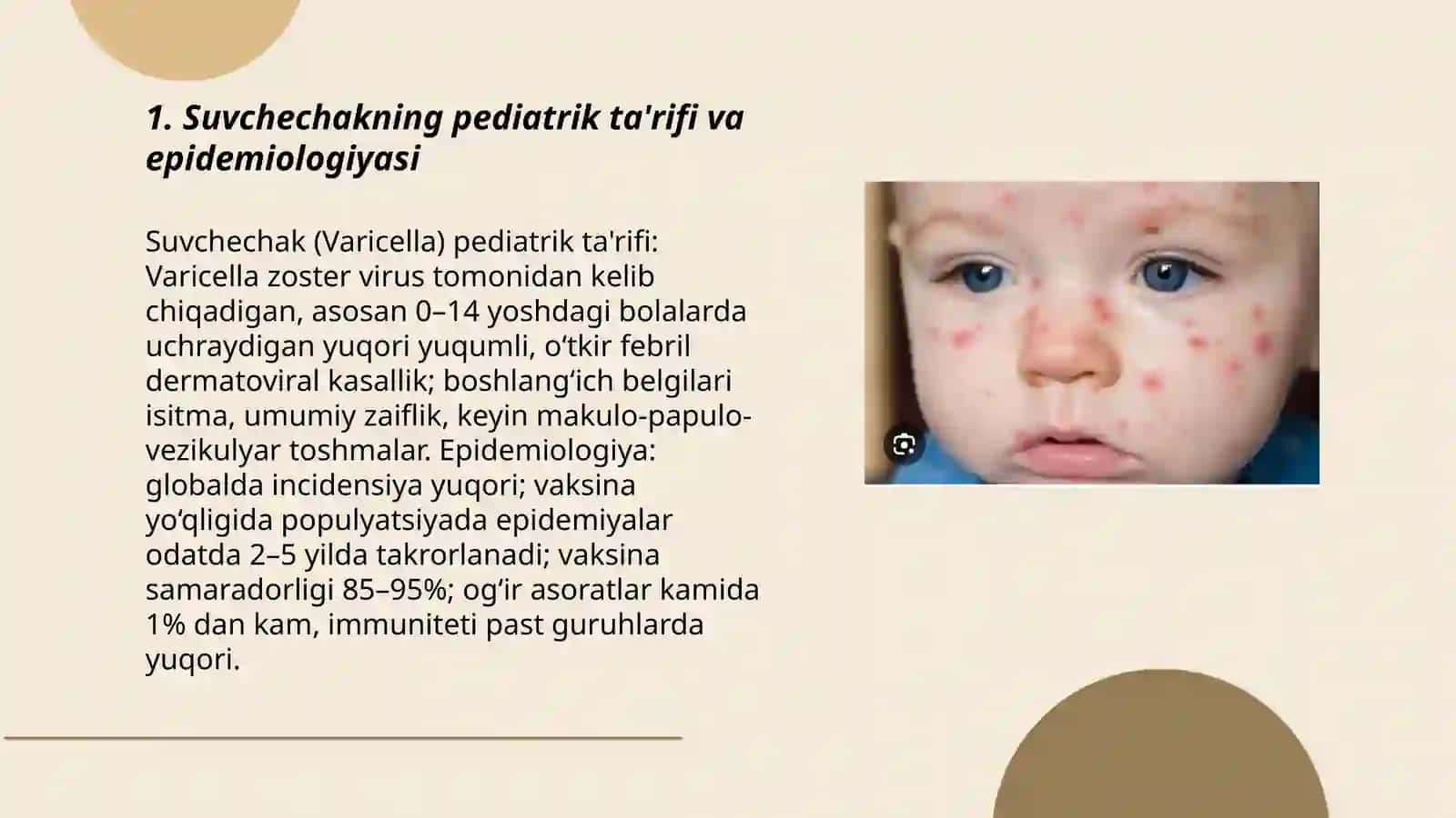 Suvchechakning pediatrik ta'rifi va epidemiologiyasi 3