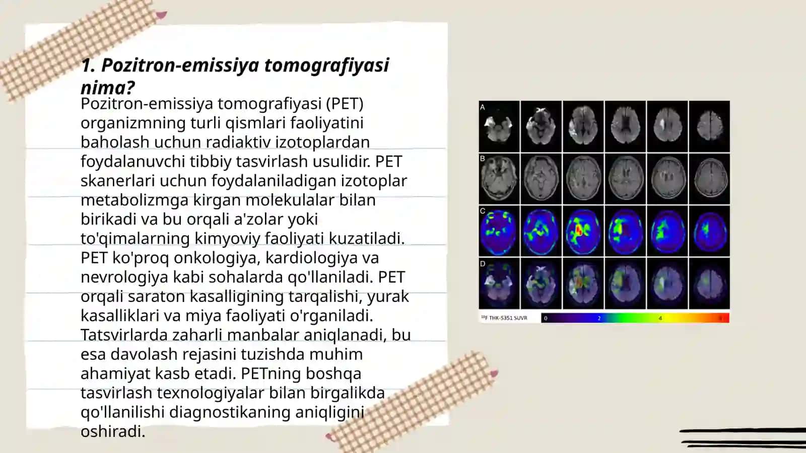 Pozitron-emissiya tomografiyasi 3
