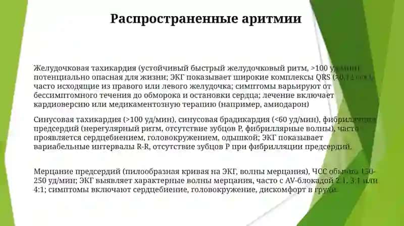 ЭКГ 3