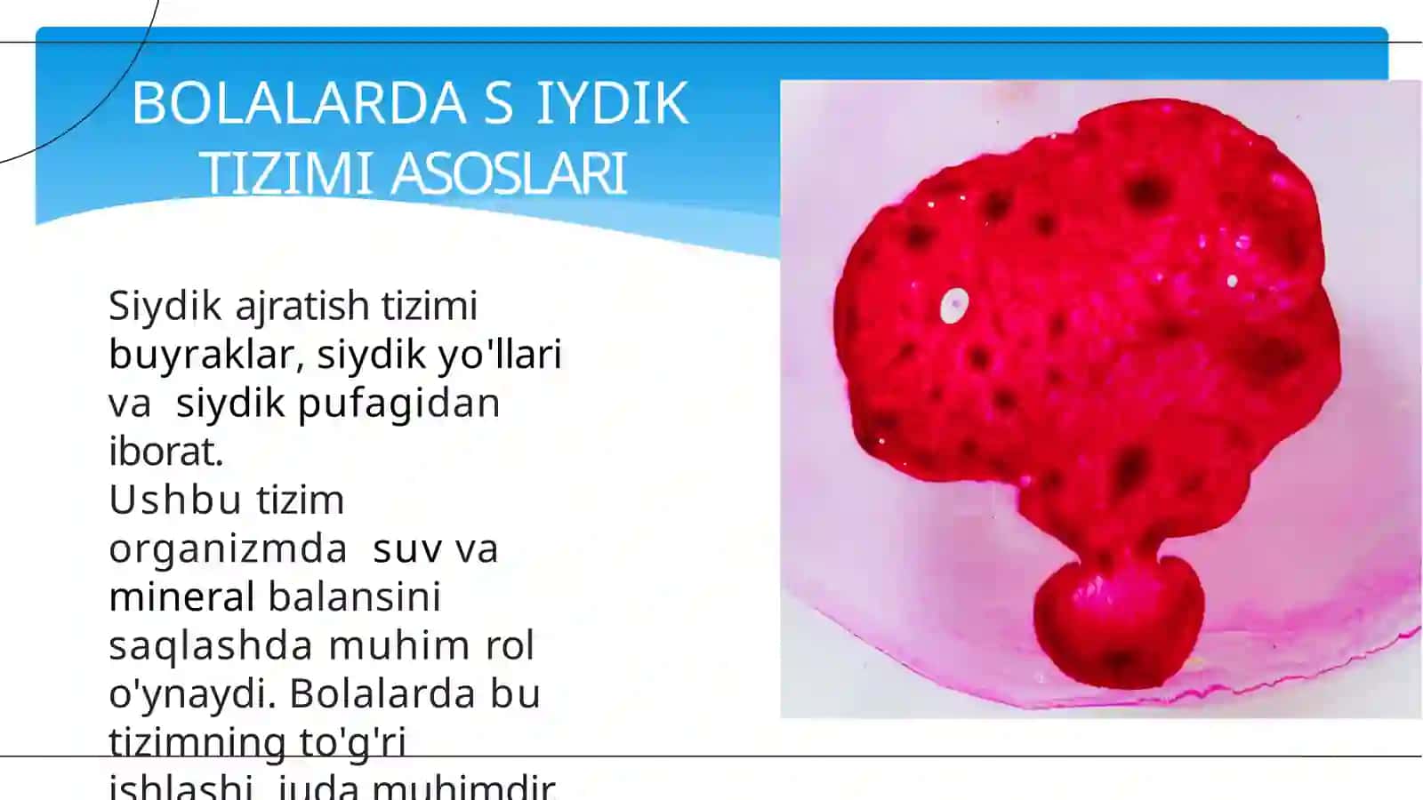 Bolalarda siydik ajratish  tizimi nuqsonlari 3