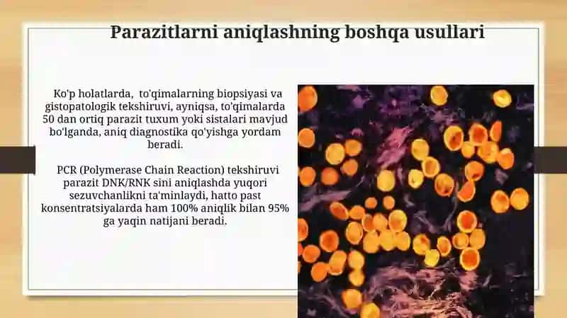 Parazitar kasalliklarning diognostika usullari 3