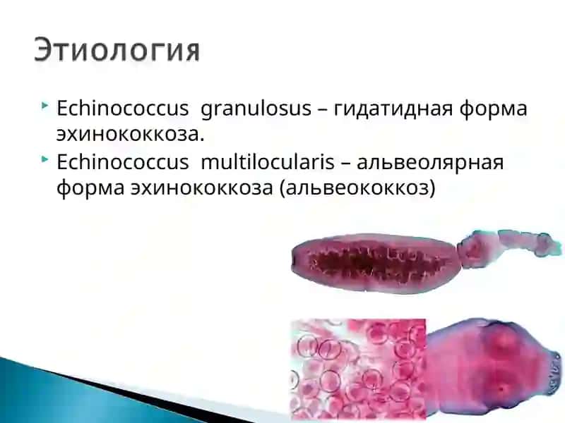 Гельминтоз человека и животных 3