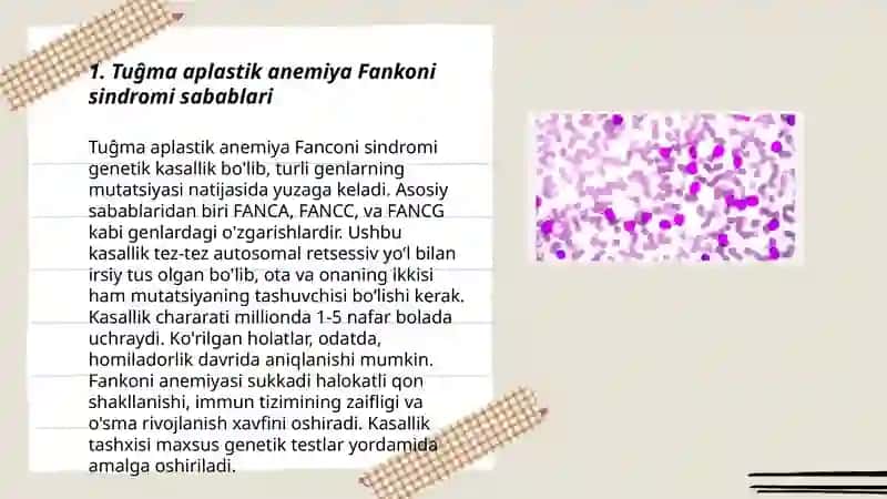 Tuĝma applastik anemiya Fankoni 3
