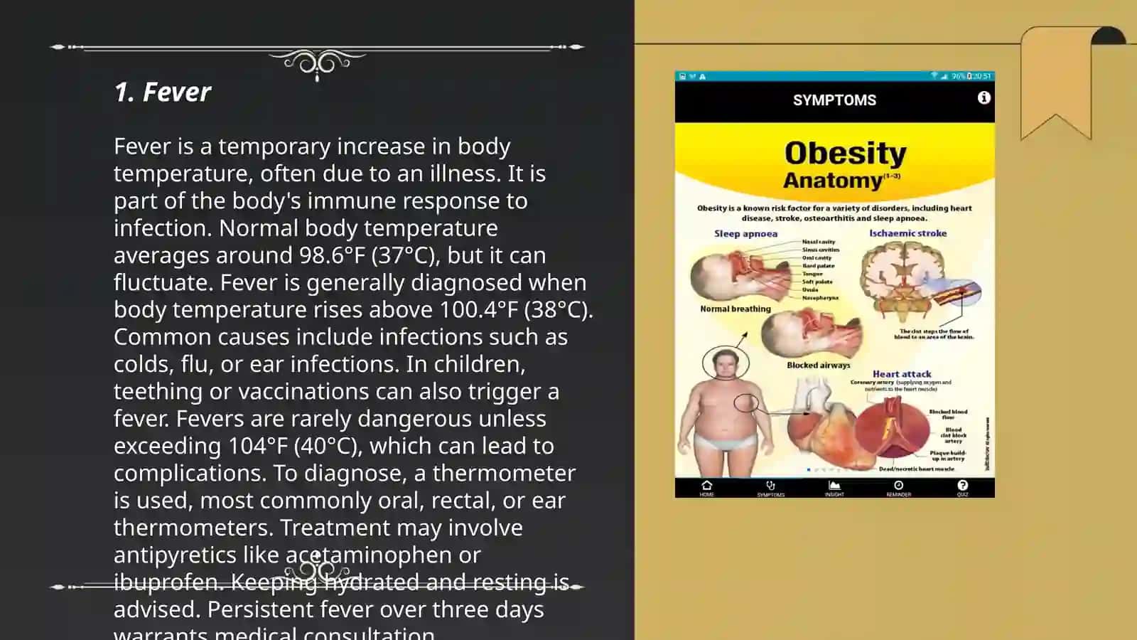 Sign and symptoms - Davronov Boburjon 3