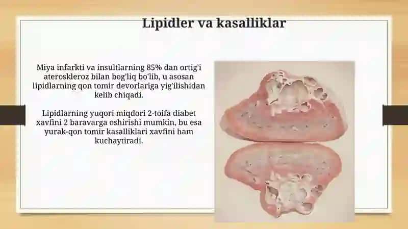 Lipidlar va yog'lar 3