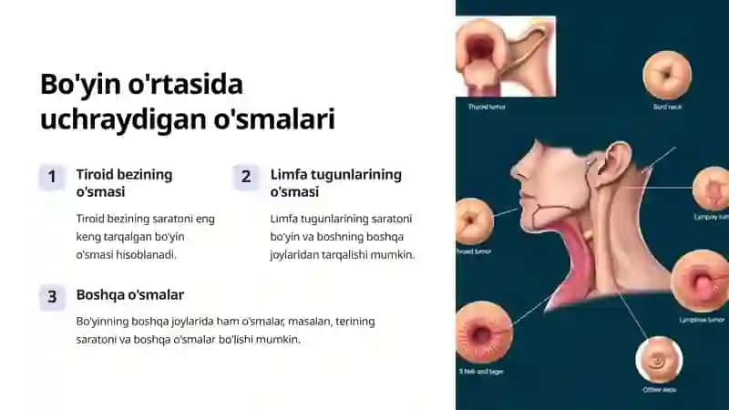 Bo'yin o'rtasi, yon oqmalari va kistalarini kesib olish 3