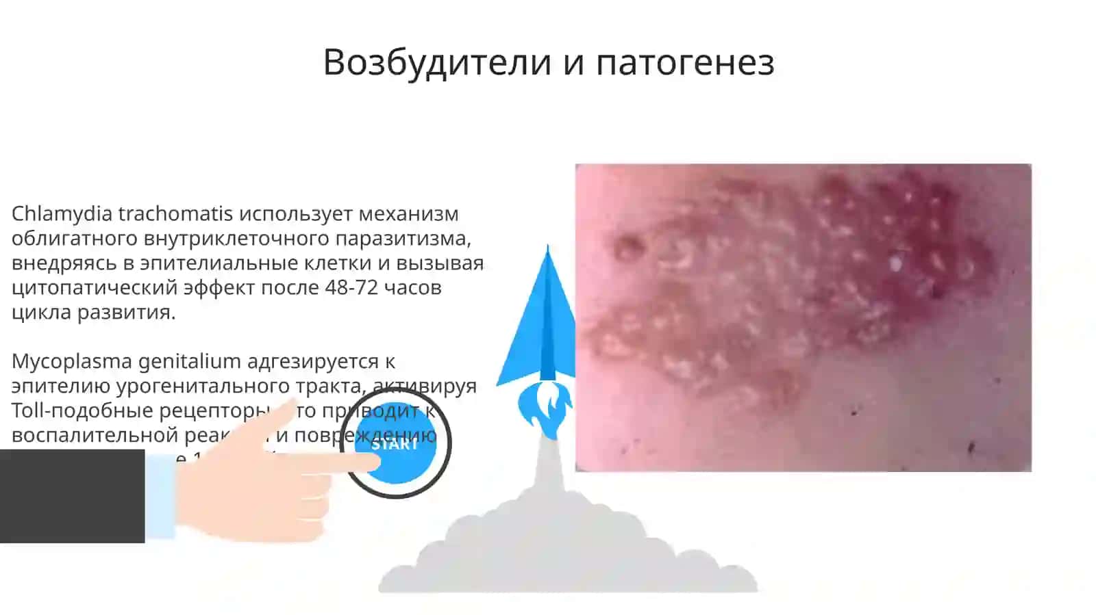Хламидиоз,микоплазмоз,трихомониаз,мягкий шанкр: характеристика возбудителей и диагностика 3