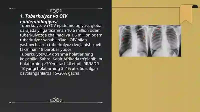 Tuberkulyoz va OIV 3
