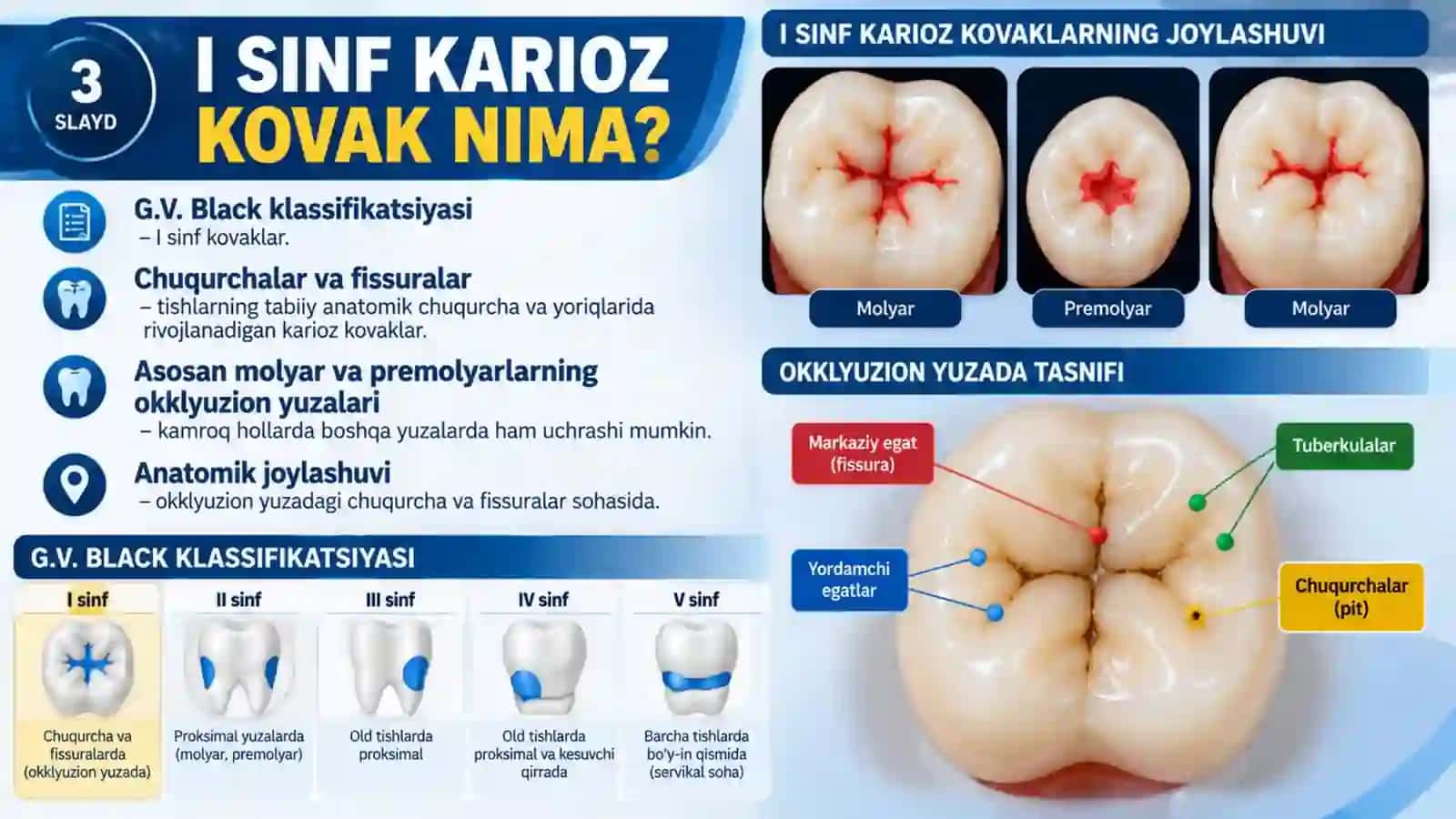 Fantomlarda I sinf karioz kovaklarni charxlash va plombalash.pptx 3