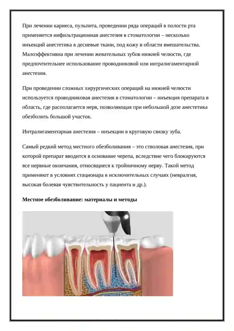 Обезболивание при стоматологических вмешательствах 3