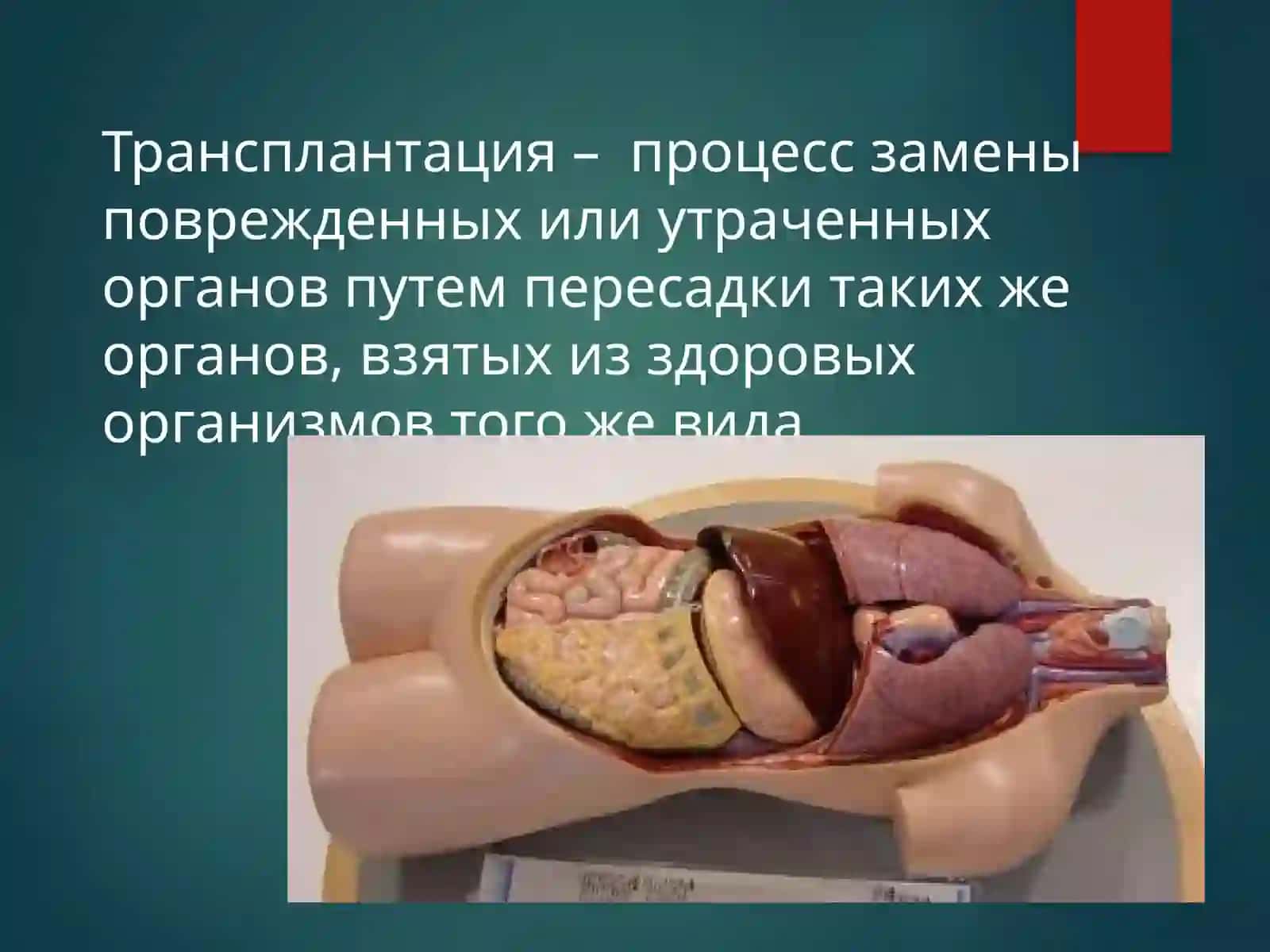Трансплантация 3