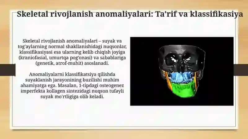 Skeletning rivojlanish anomaliyalari 3
