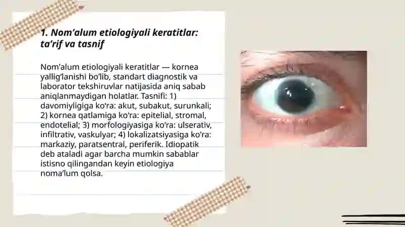 Nomʼalum etiologiyali keratitlar 3