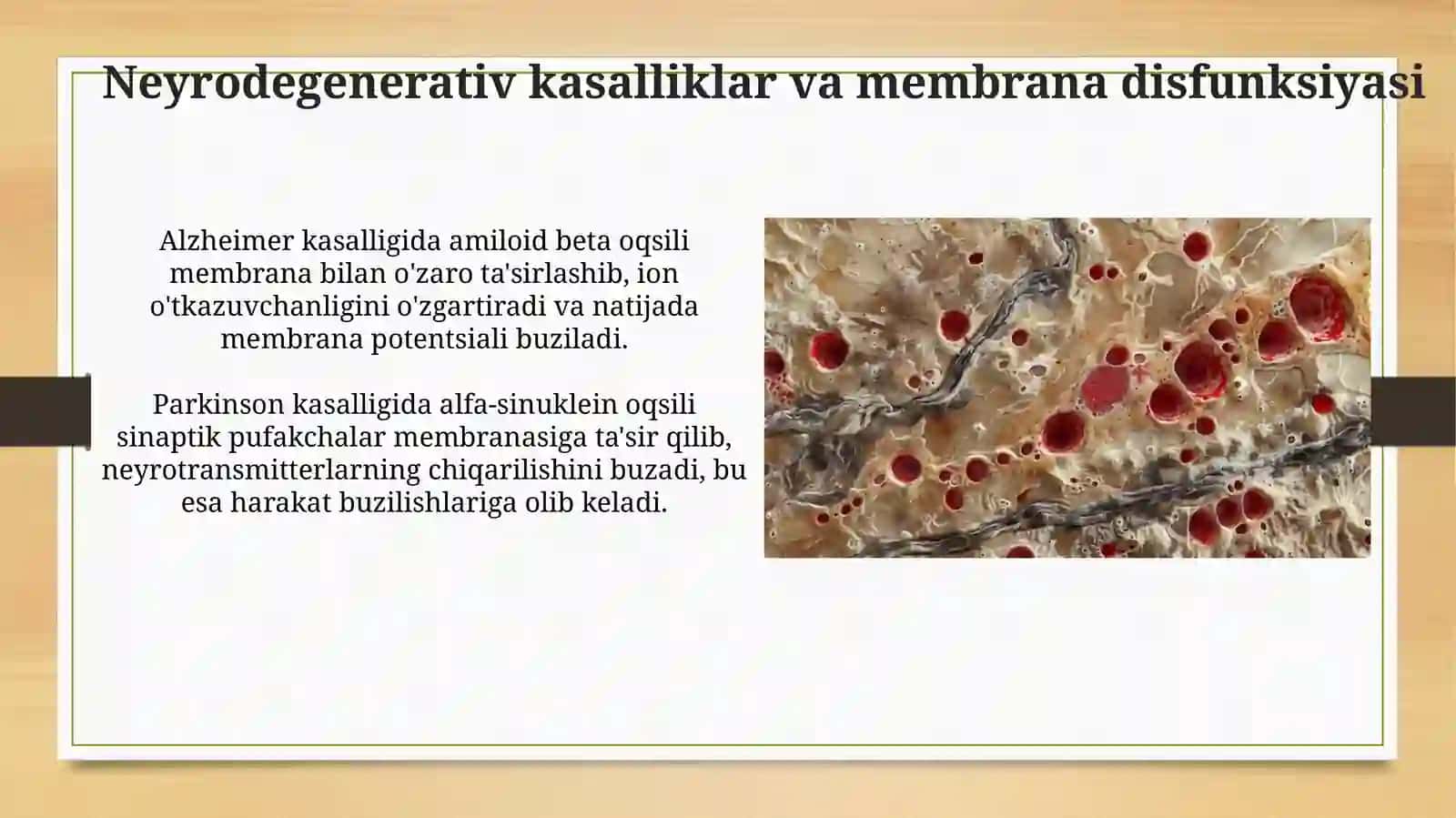 Membranalar bilan bog'liq kasalliklar 3