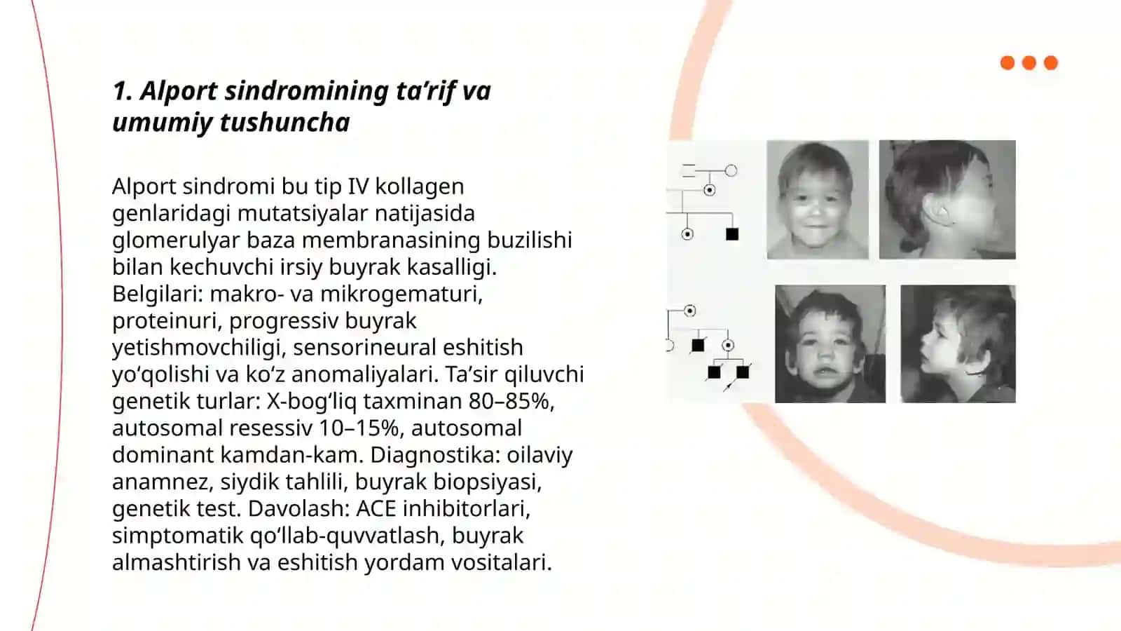 Alport sindromi 3