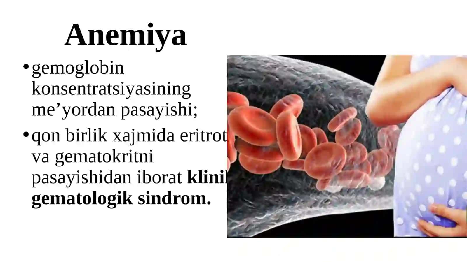 Somatik kasalliklar va homiladorlik. Anemiya 3