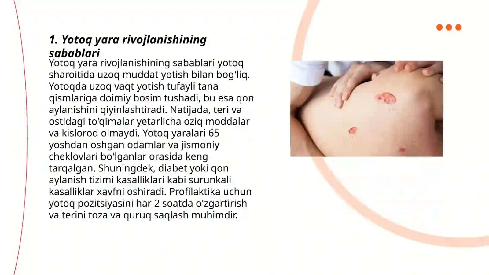 Yotoq yara profilaktikasi.Yatrogeniya muommolari 3