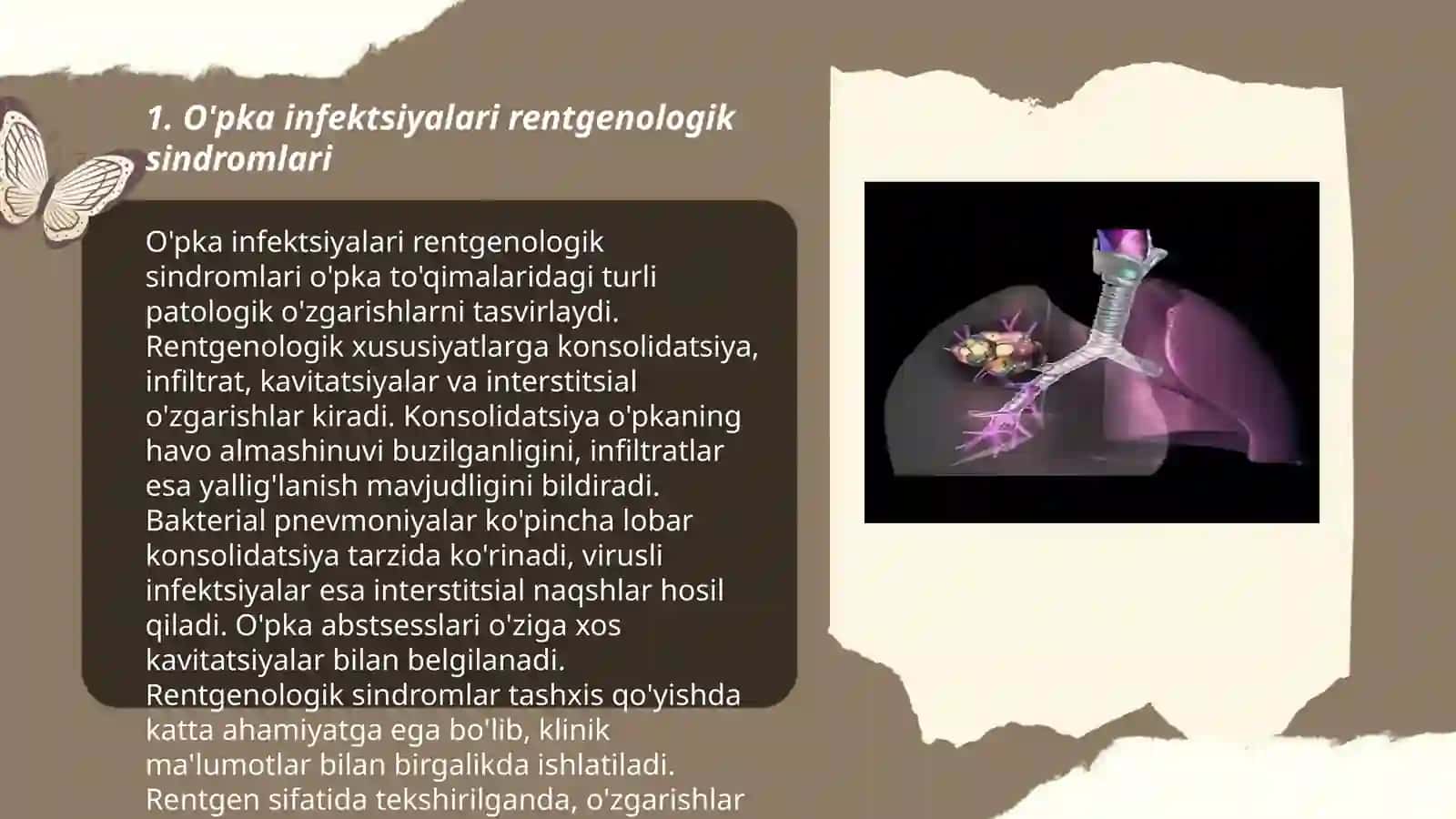 O'pka infektsiyalari rentgenologik sindromlari 3