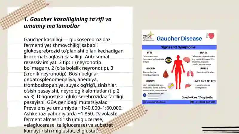 Gaucher kasalligi 3