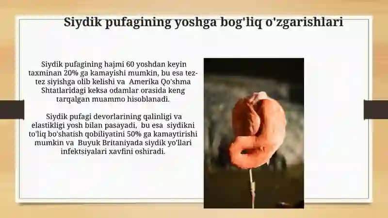 Siydik pufagi 3