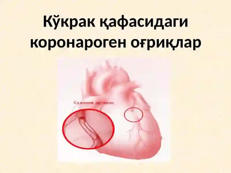 Кўкрак қафасидаги коронароген оғриқлар 3