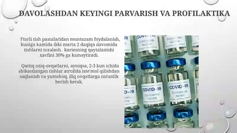 Kariesni davolash usullari 3