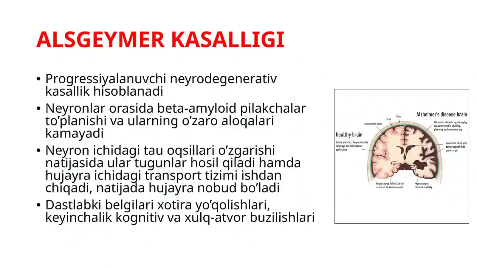 ALSGEYMER KASALLIGIDA VA EPILEPSIYADA QO’LLANILADIGAN DORILAR 3