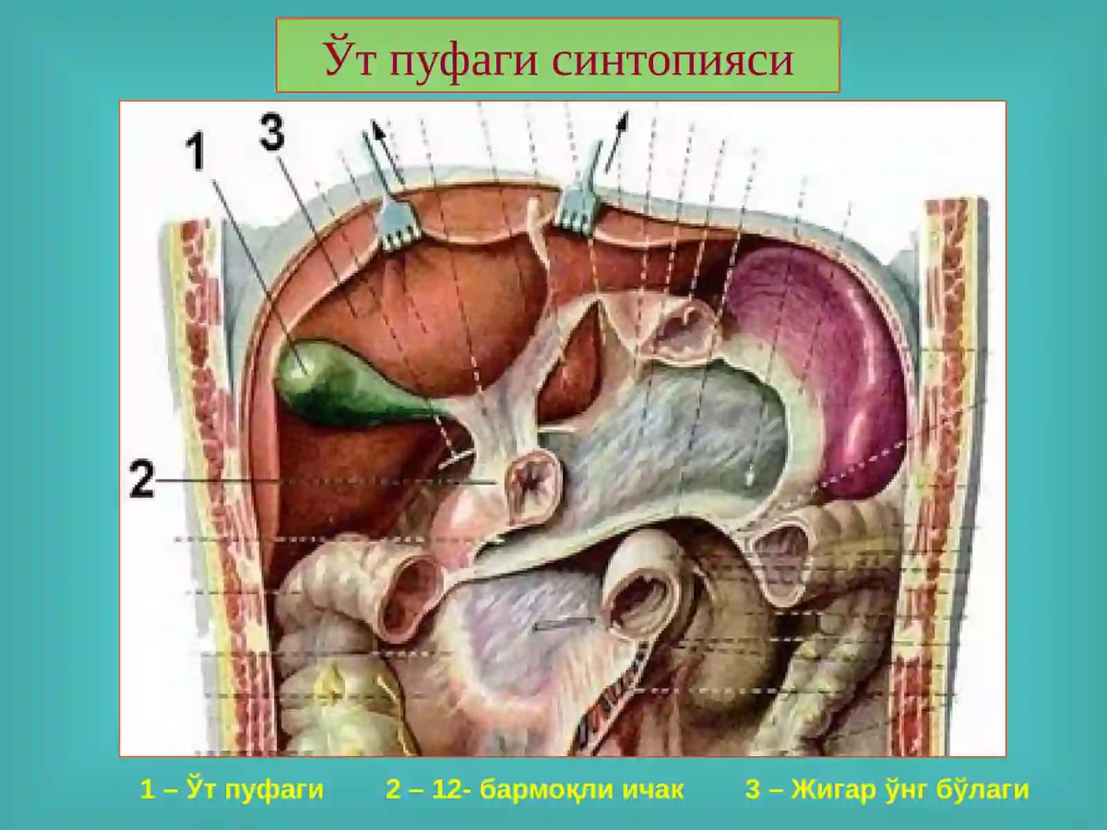 ЎТ-ТОШ КАСАЛЛИГИ. ХОЛЕЦИСТИТЛАР, ДИАГНОСТИКАСИ ВА ДАВОЛАШ 3