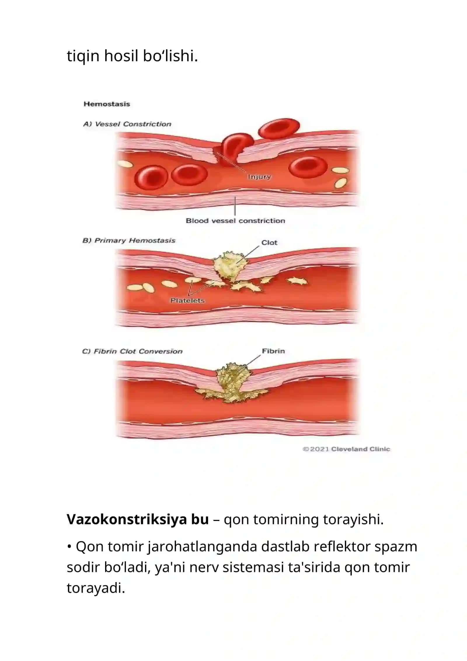 QON IVISHI – GEMOSTAZ 3