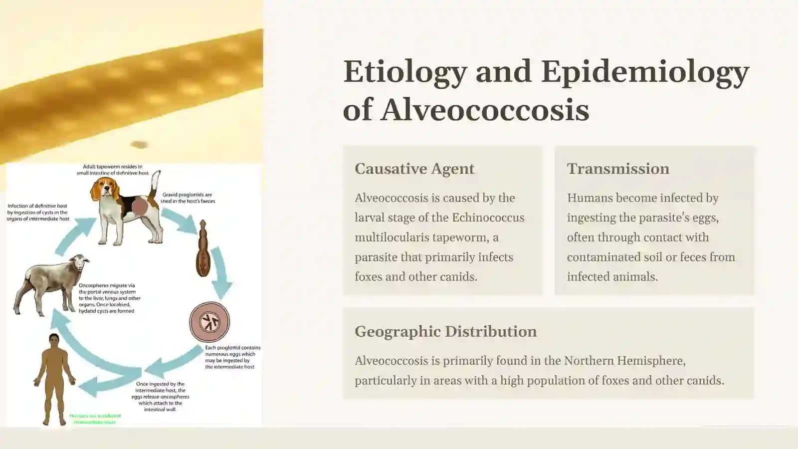 Granulomatous Liver Disease: Alveococcosis 3