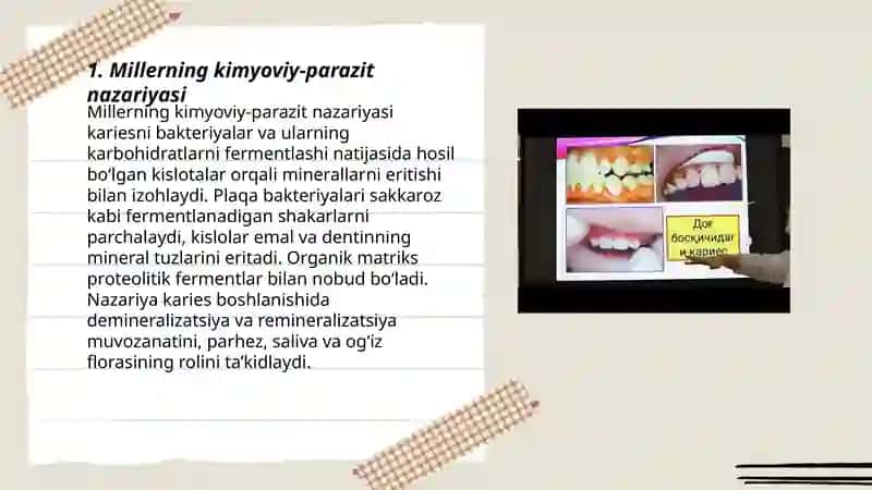 Karies kelib chiqish nazariyalari 3