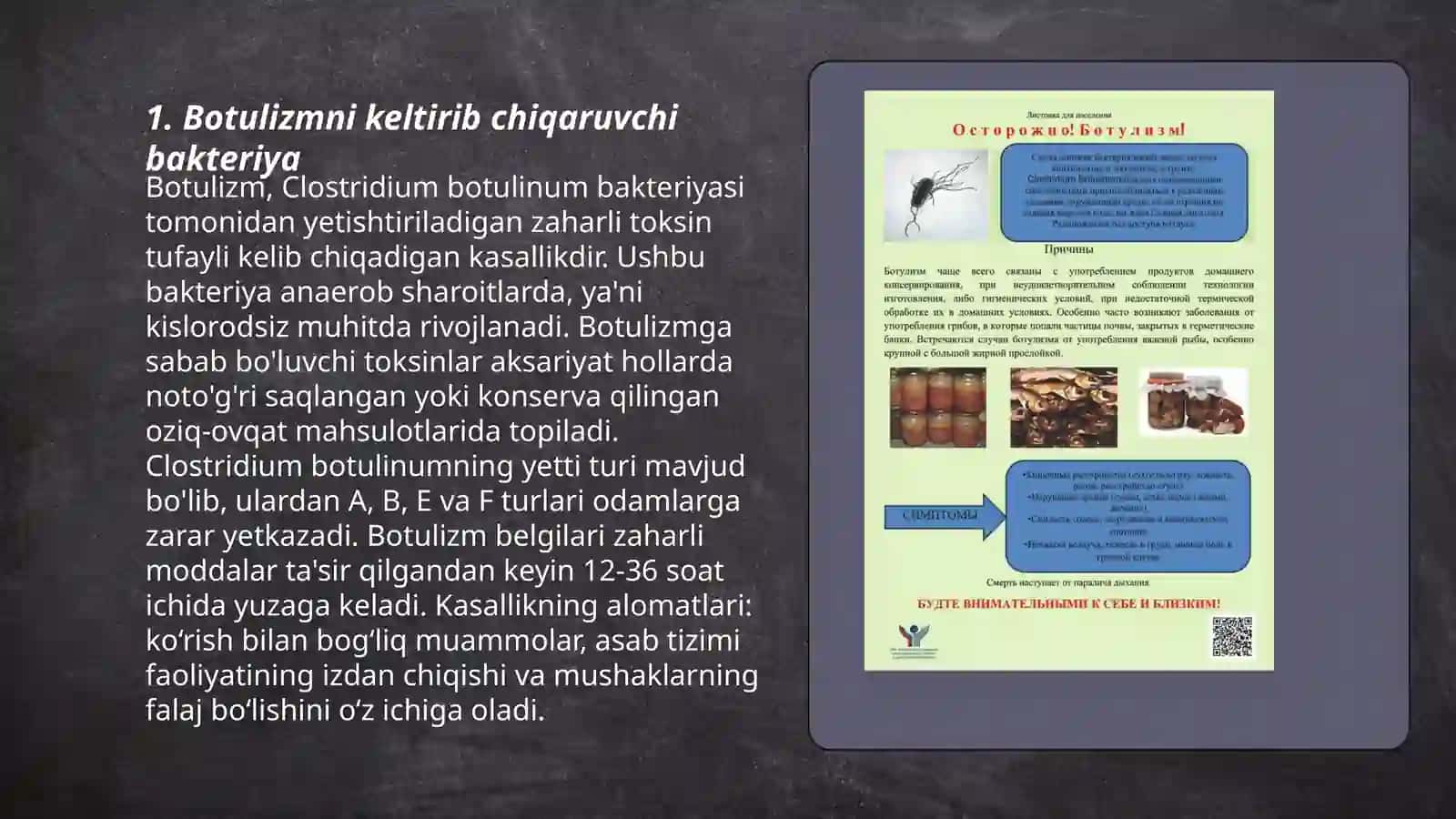 Botulizm ovqat toksikoinfeksiyalari 3